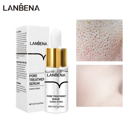 LANB́ENA™ - Mitesser Maske & Poren Serum [SET]